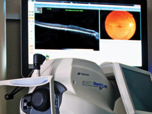 Ocular Coherence Tomography (OCT)